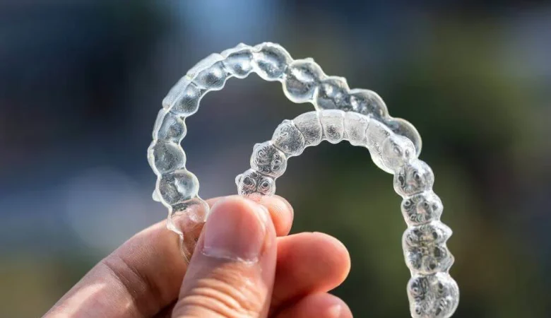 Ερωτήσεις Invisalign: 3 Συχνές Ερωτήσεις